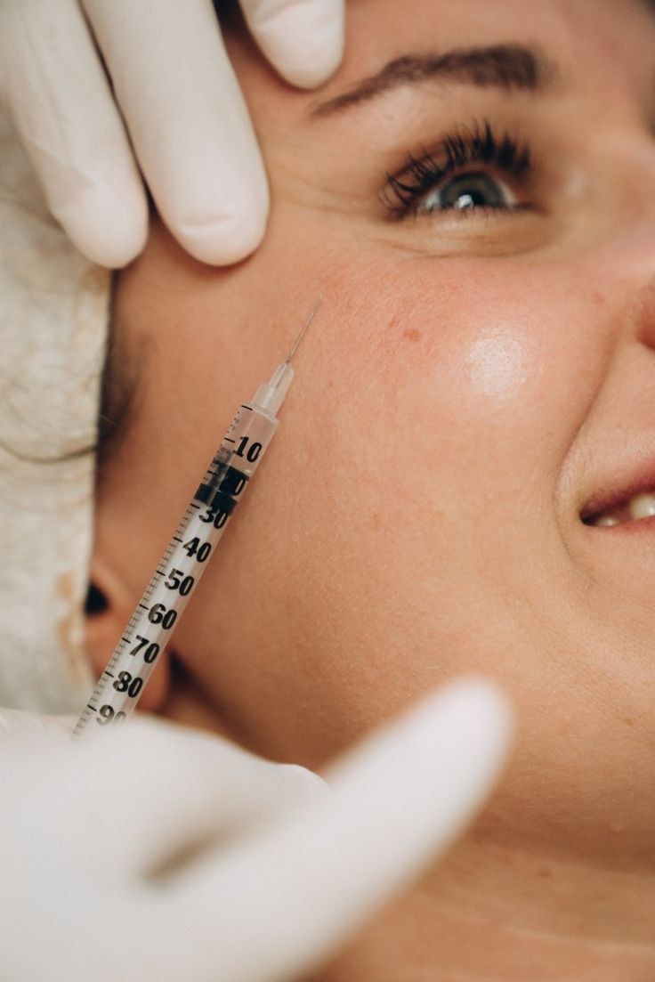 Anti-wrinkle Injections