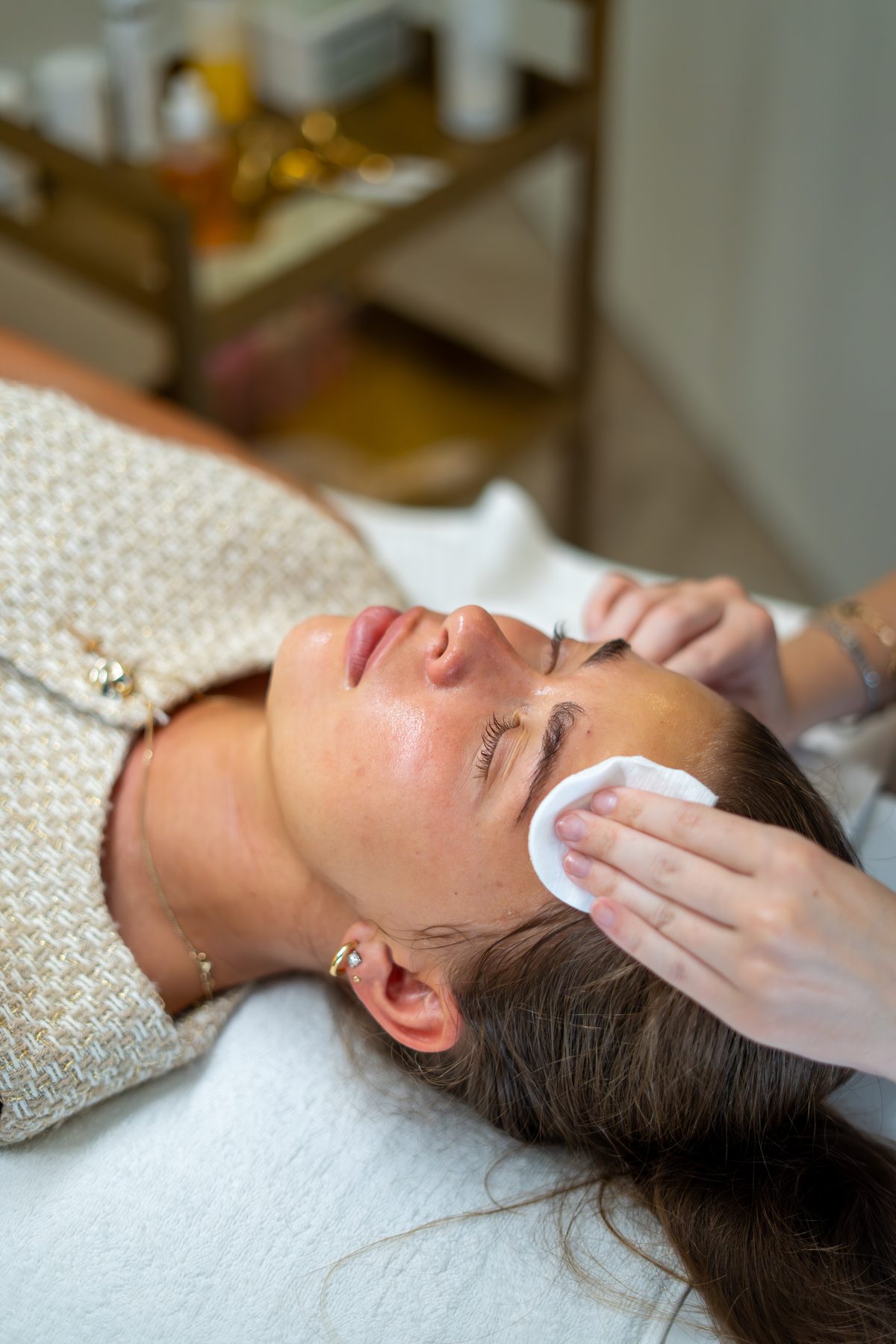 Chemical Peel