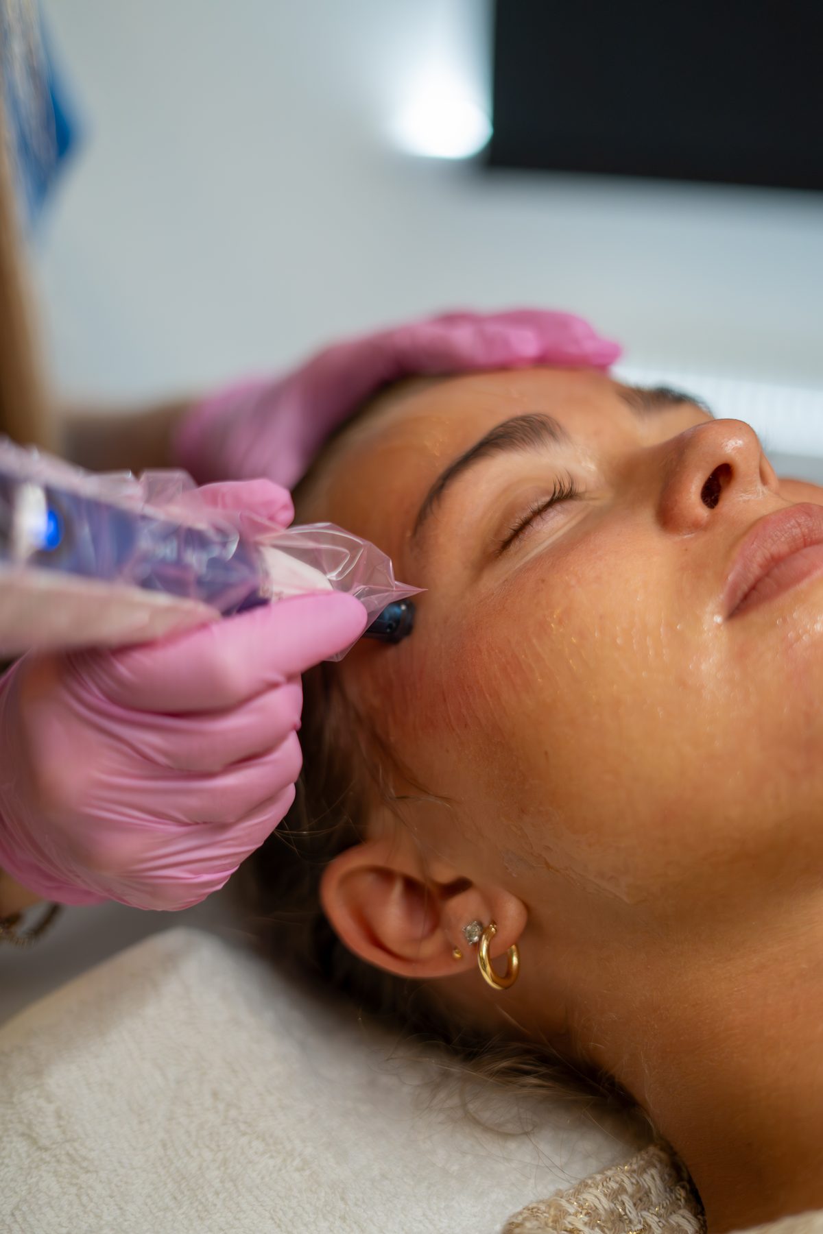 Facials & Microneedling