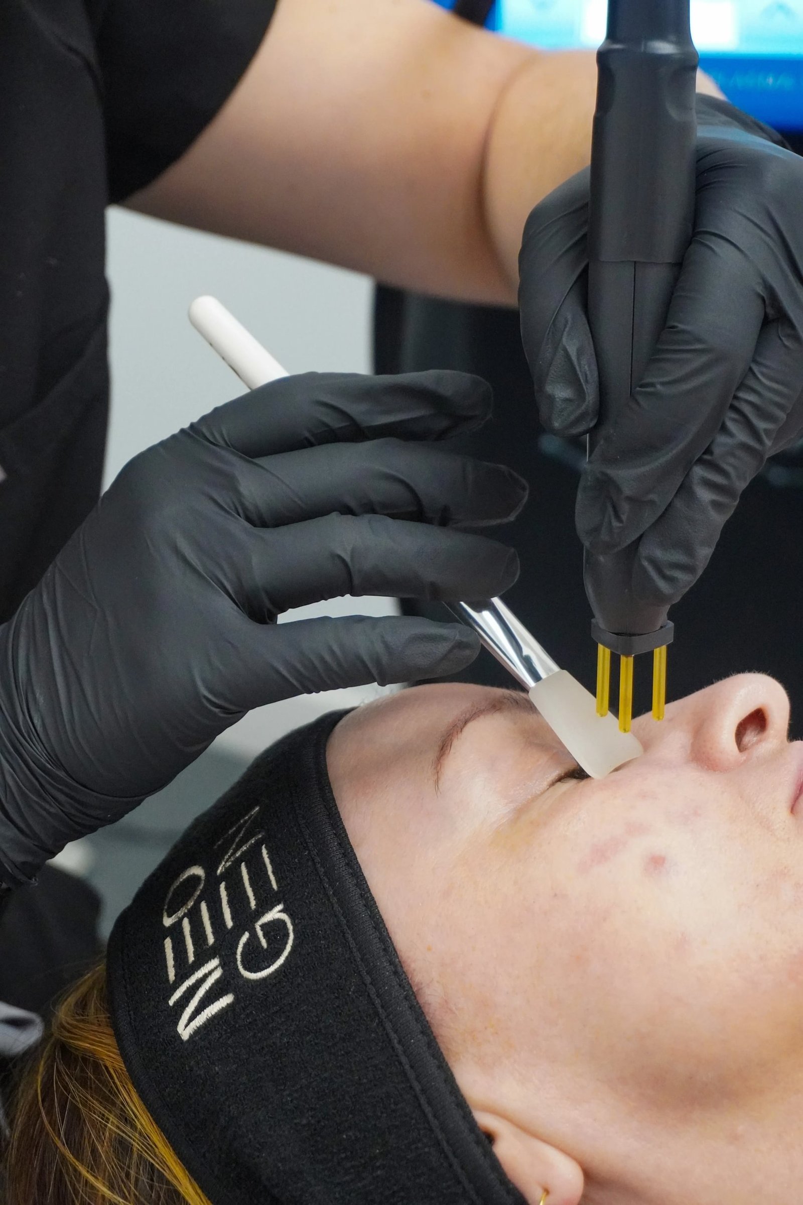 NeoGen Plasma Treatment