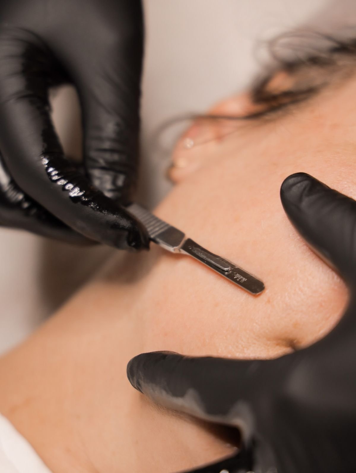 Dermaplaning Facials Treatments