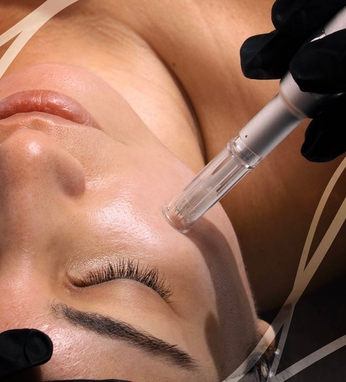 Facials & Microneedling